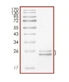 The purity of KRAS (G12D, lsoform B) was determined to be >70% by densitometry. Observed MW ~24-27 kDa. Calculated MW ~21 kDa.<br />(Note: top band present due to post-translational modifications on KRAS lsoform B)